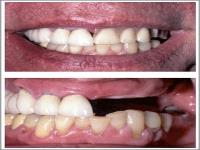 Westpark Dental-Dr. Keith S. Tang, DDS image 4